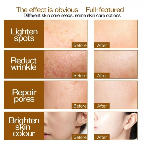 Луксозен дерма ролер за лице с 540 игли