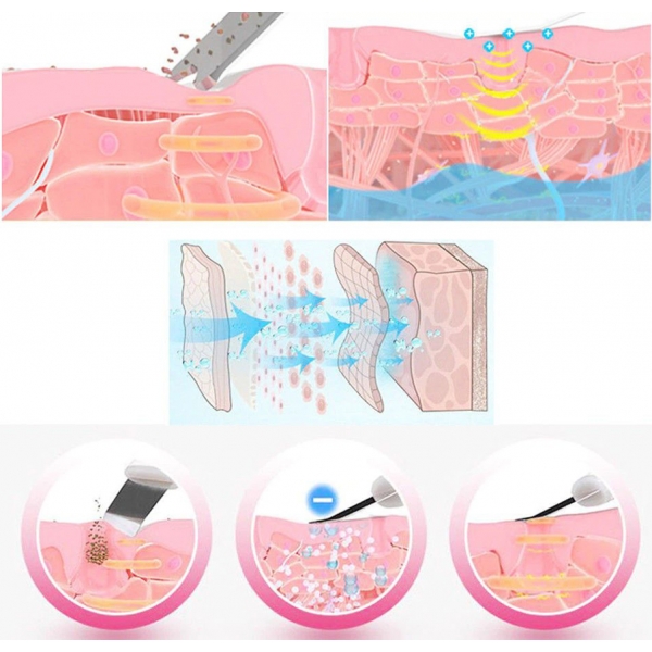 Ултразвуков фриматор за лице J618